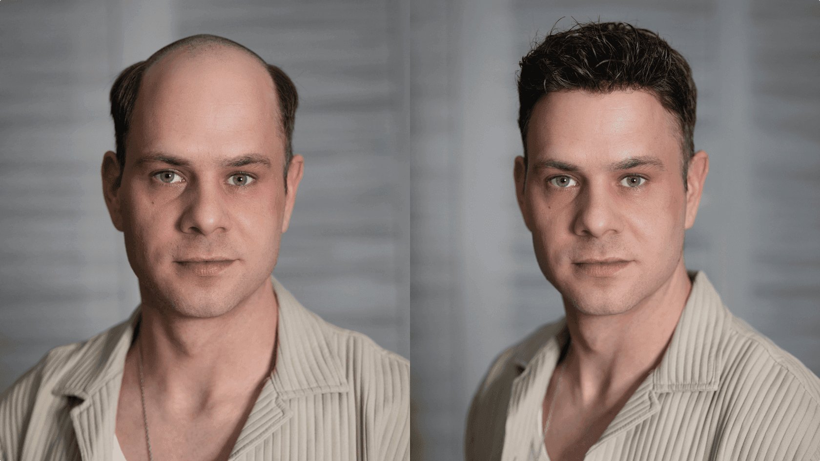 Three Thin Skin Men's Hair Systems: 0.03mm, 0.06mm and 0.08mm - Choose the One That's Best for You