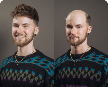 Neo | Men's Hair Replacement Units with Natural Lace Front and Skin Perimeter
