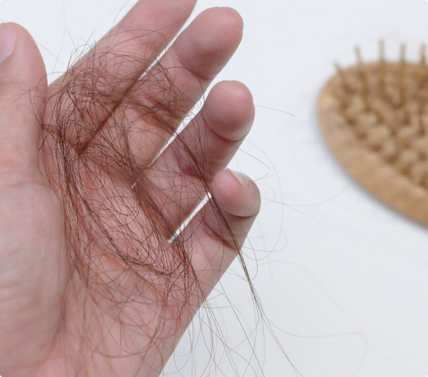 Hand holding shed hair